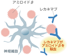 レカネマブ