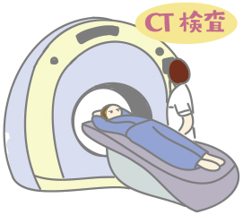 肺がん