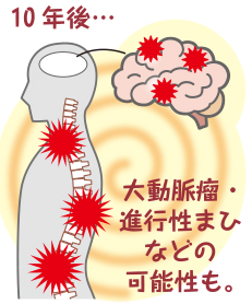 梅毒