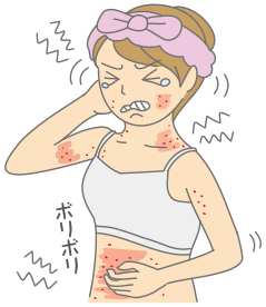 じんましん