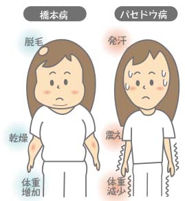 内科の現場から／甲状腺（下）