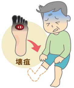 下肢救済治療